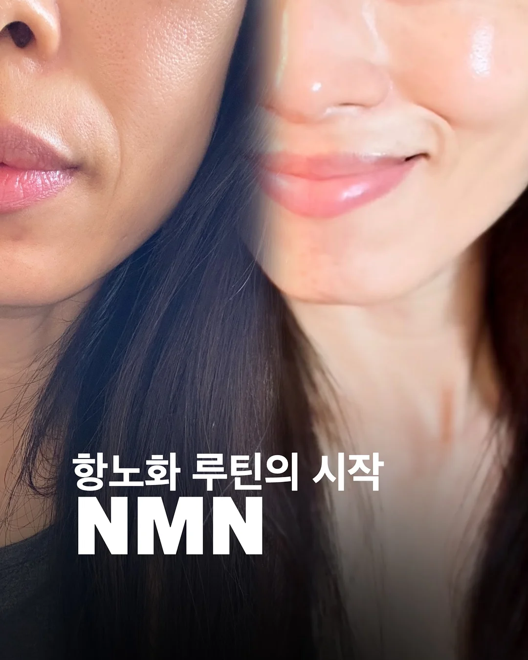 BELLZIP 뜨개 키트 1