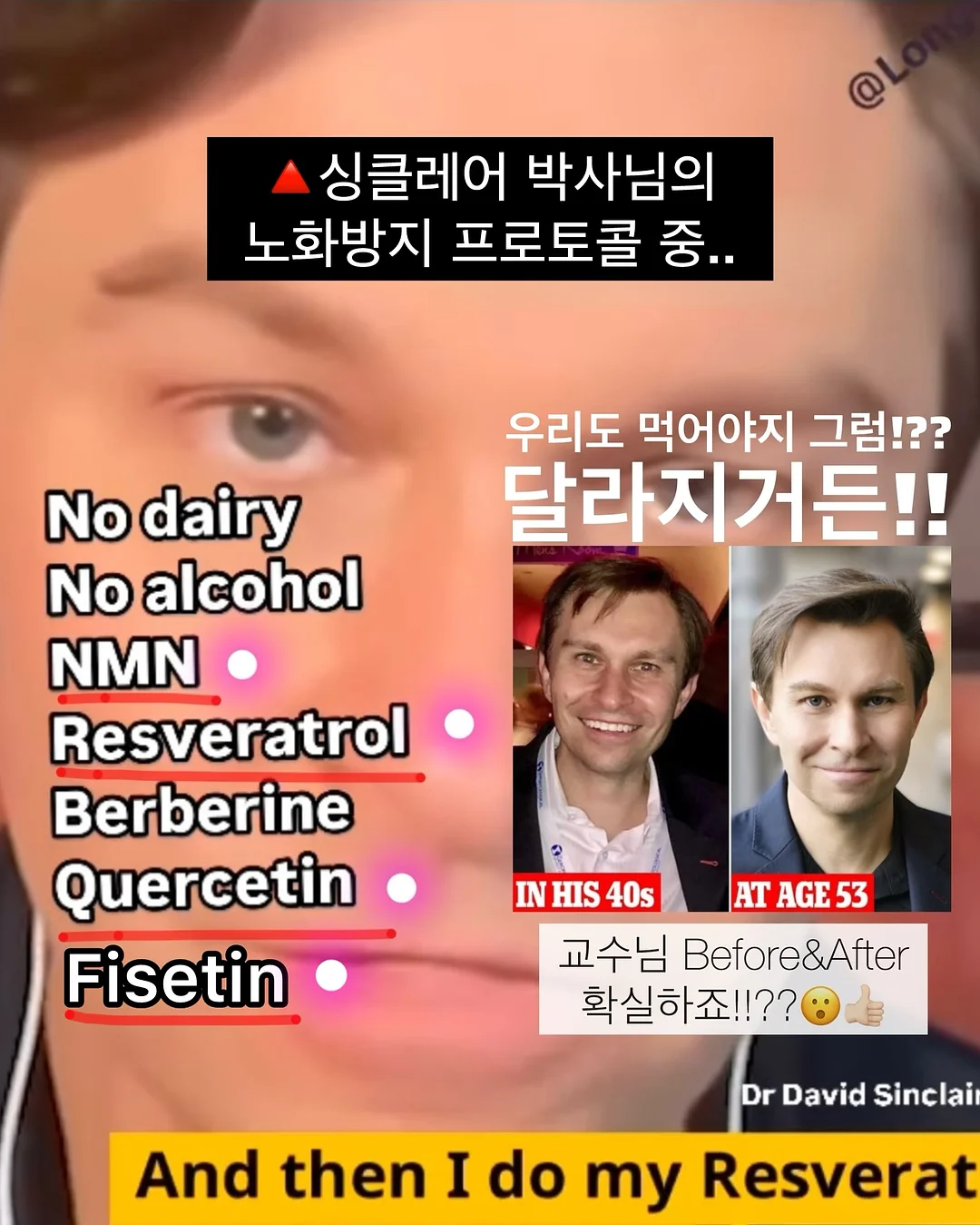 BELLZIP 뜨개 키트 16