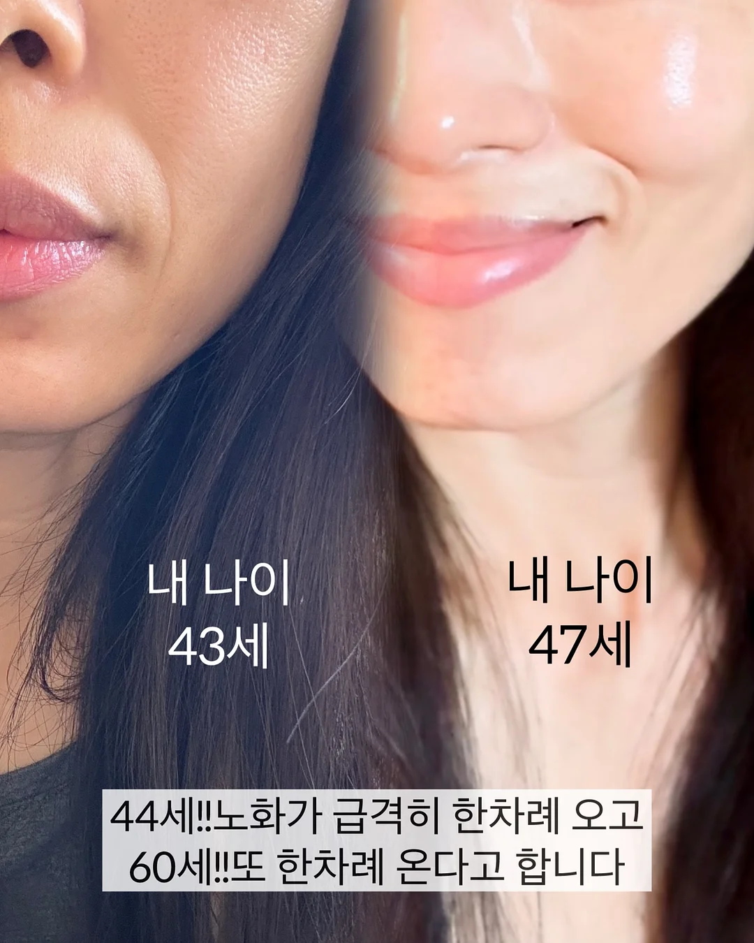 BELLZIP 뜨개 키트 2