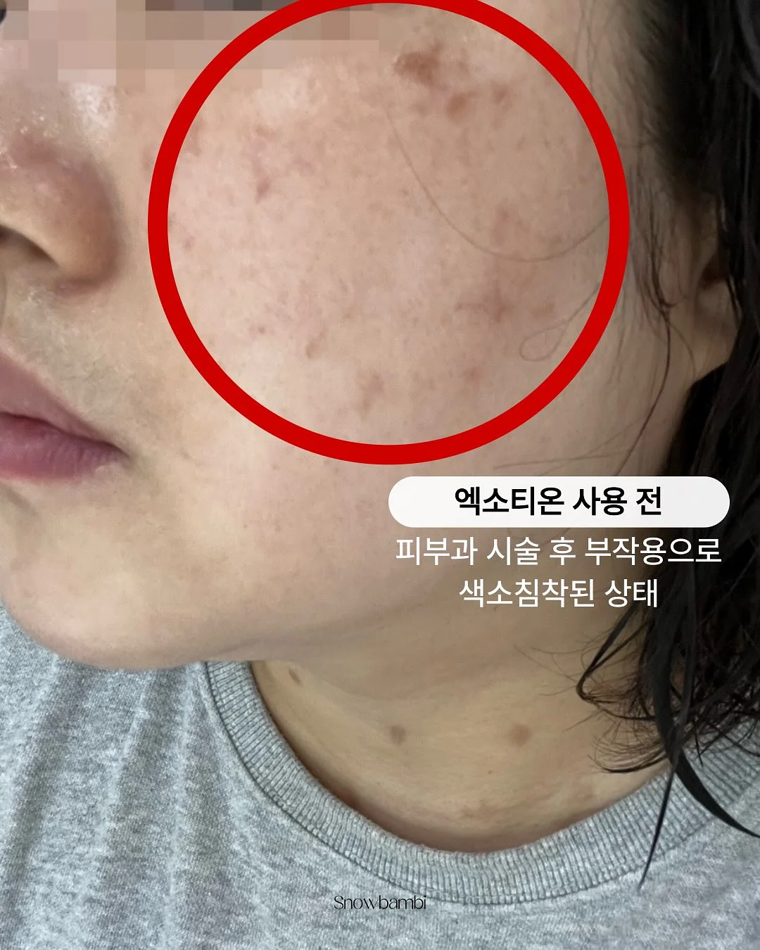랑디몰 라이브 방송 2