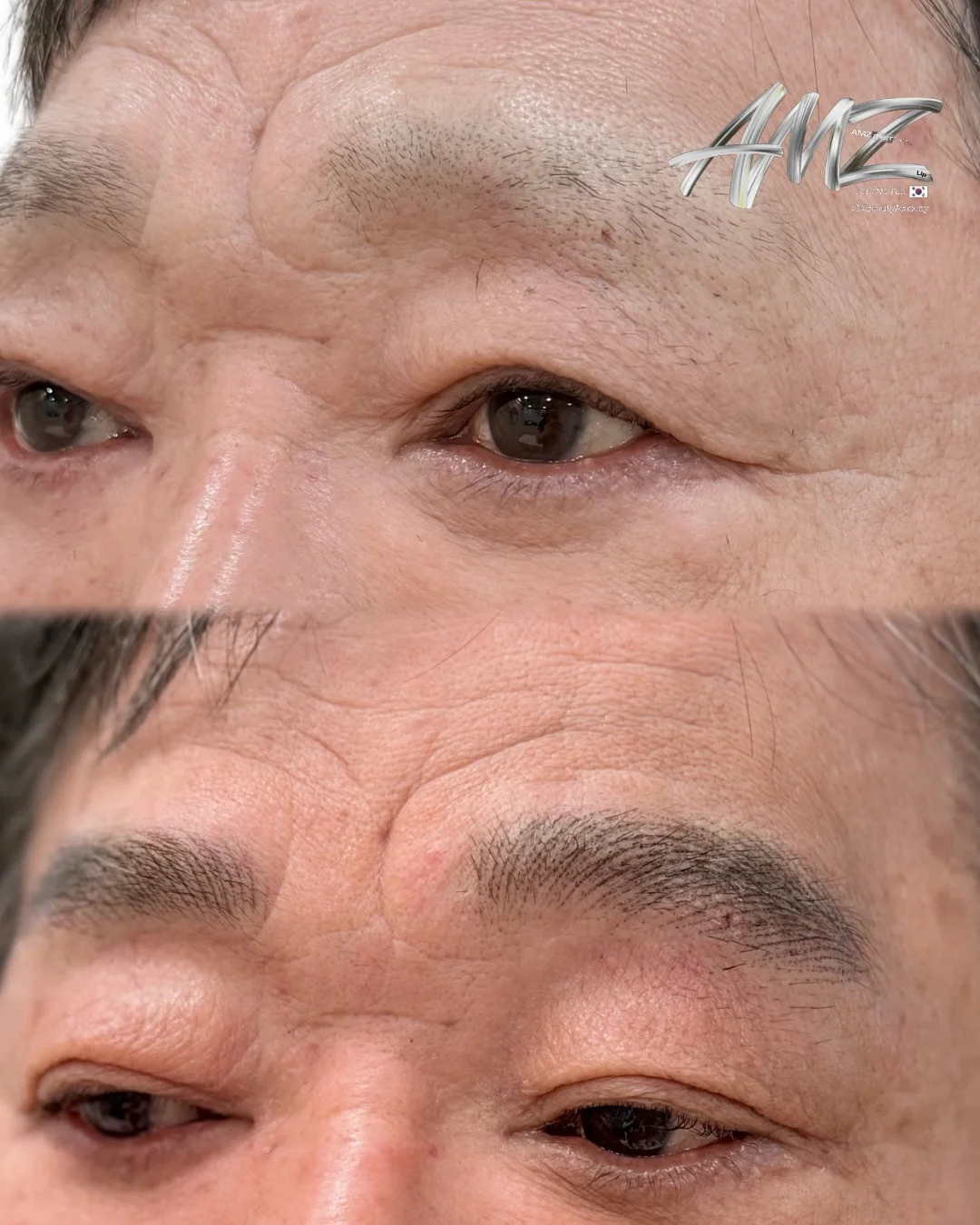 지퍼백 1