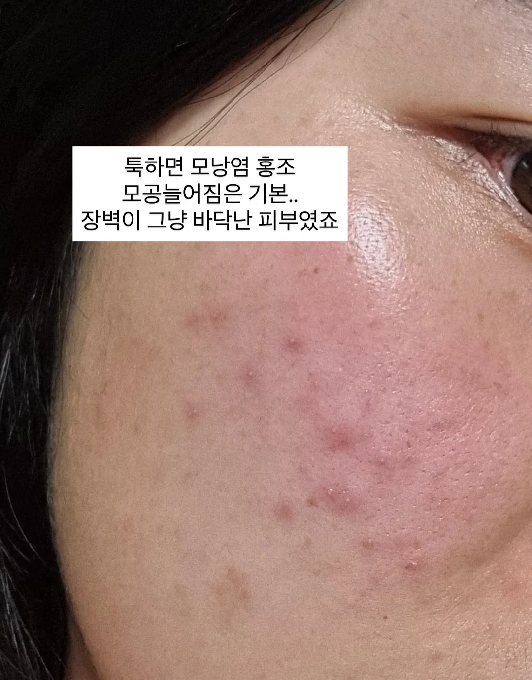킥보드 가방 11