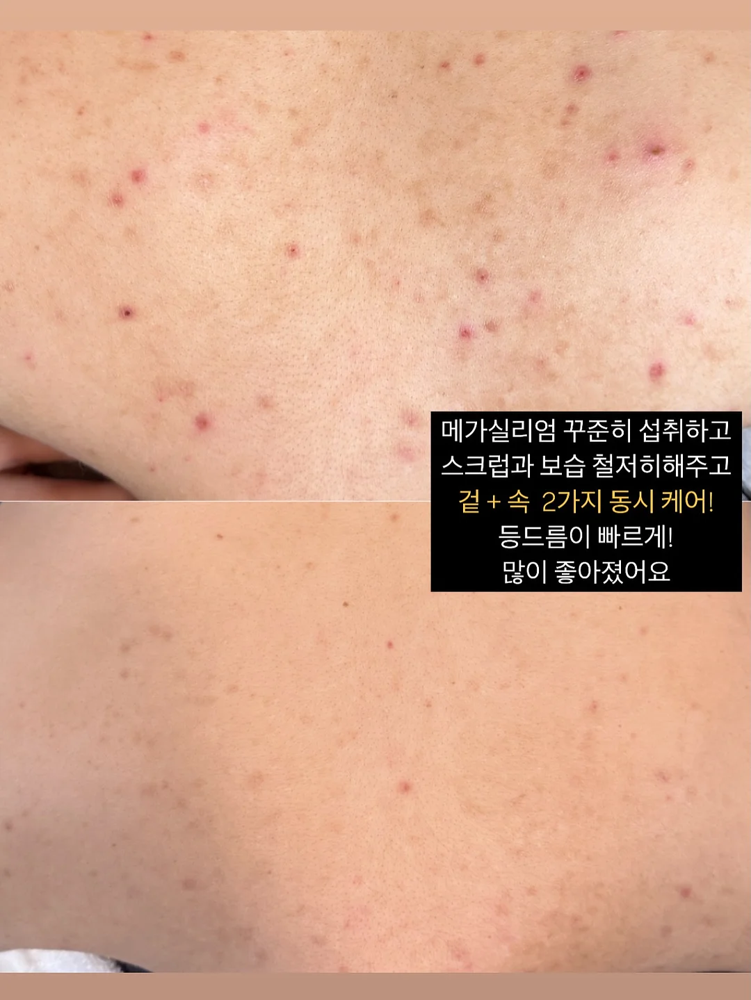 산전산후 임산부운동전문가 온라인과정 7