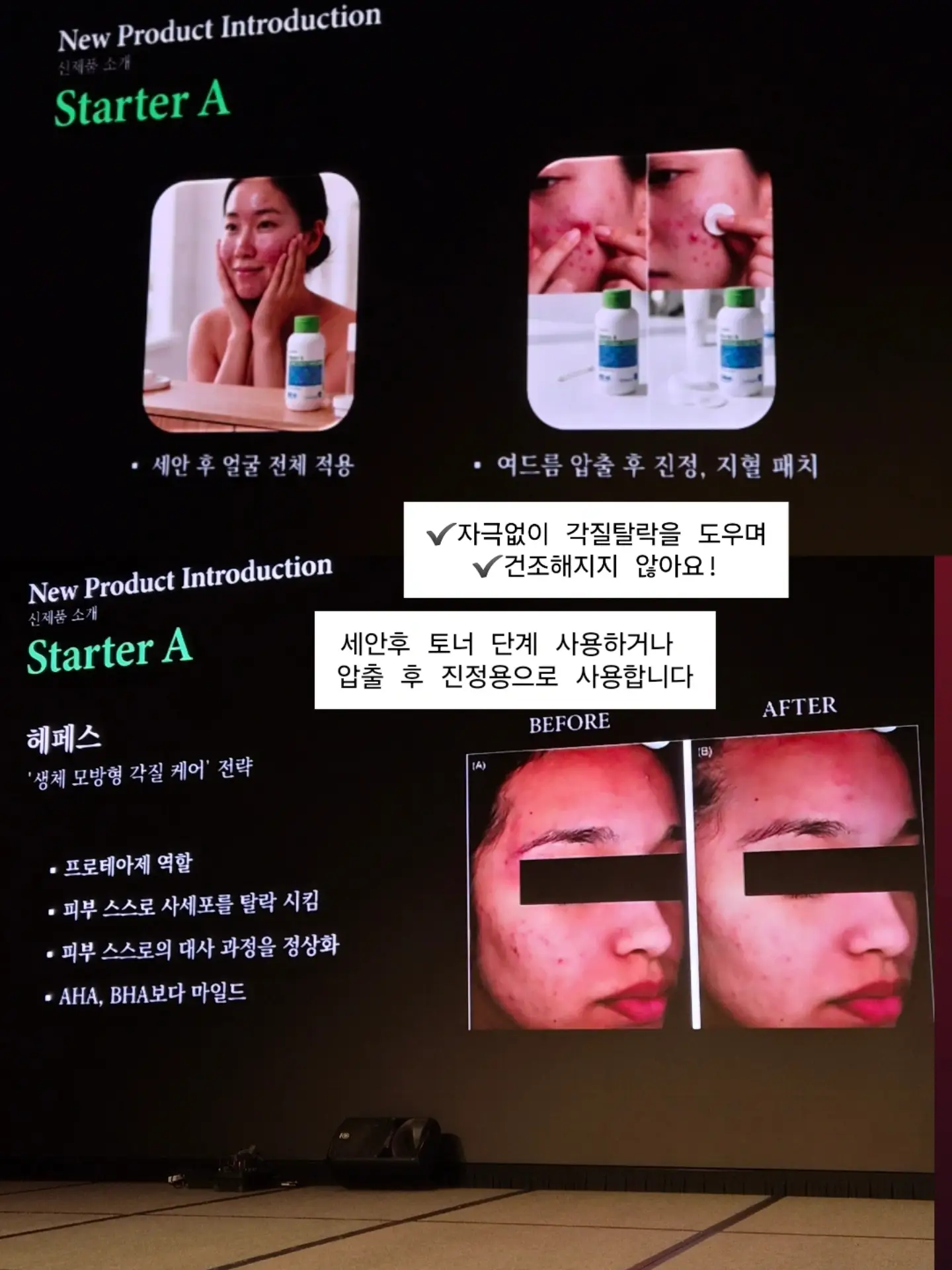 하트 포니 티셔츠 / 트리플 믹스 캉캉 스커트 6