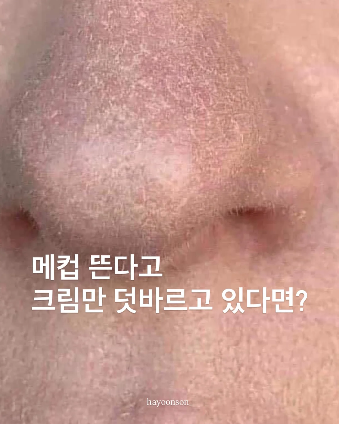 로보락 엣지2 1