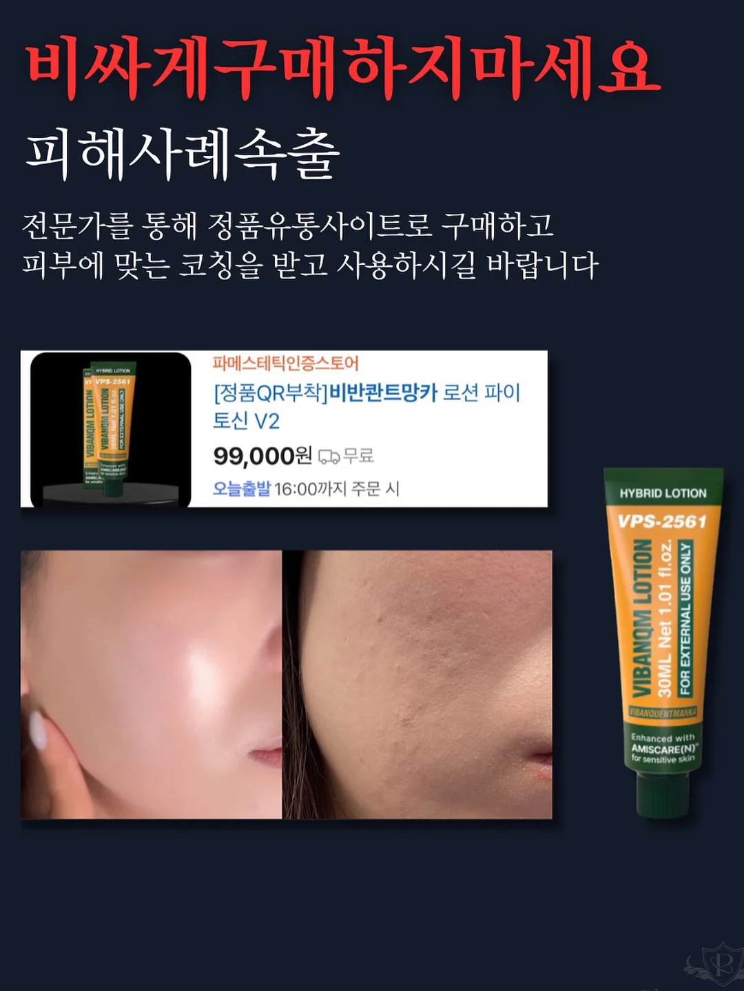 여름 블라우스 6