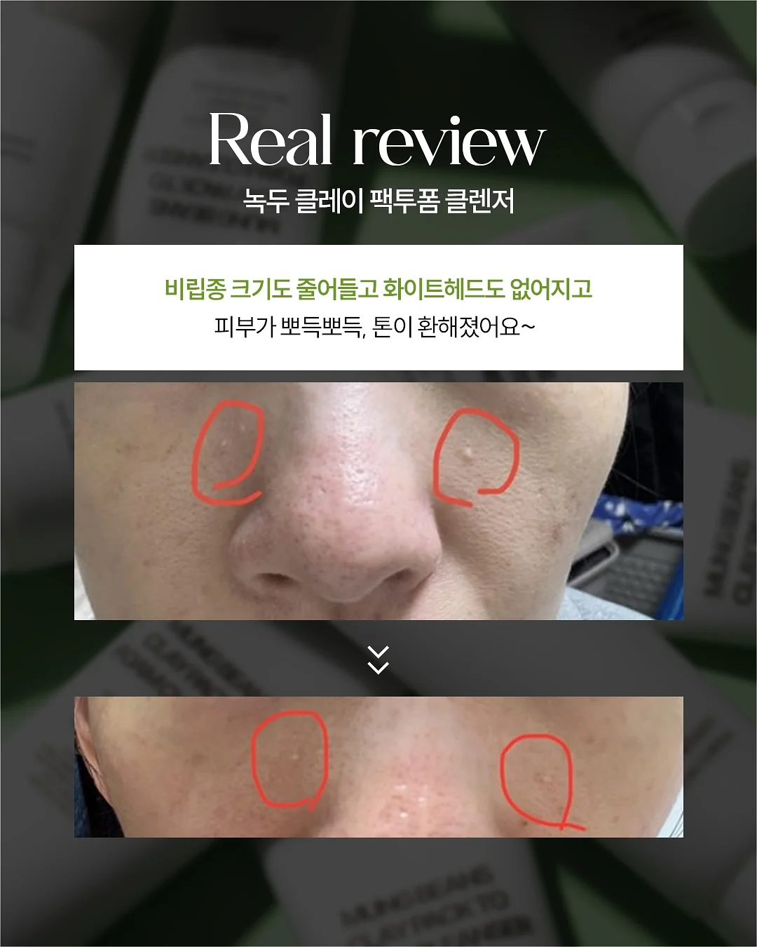 바이오디티디 비타카밍세럼 8
