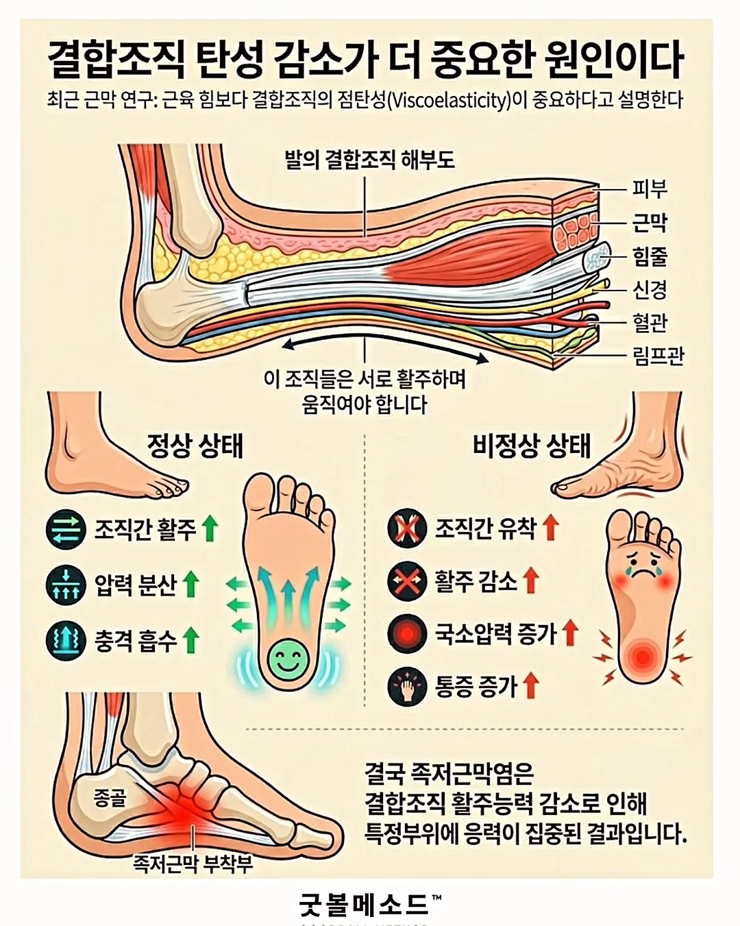 핸드 케어 비법 4
