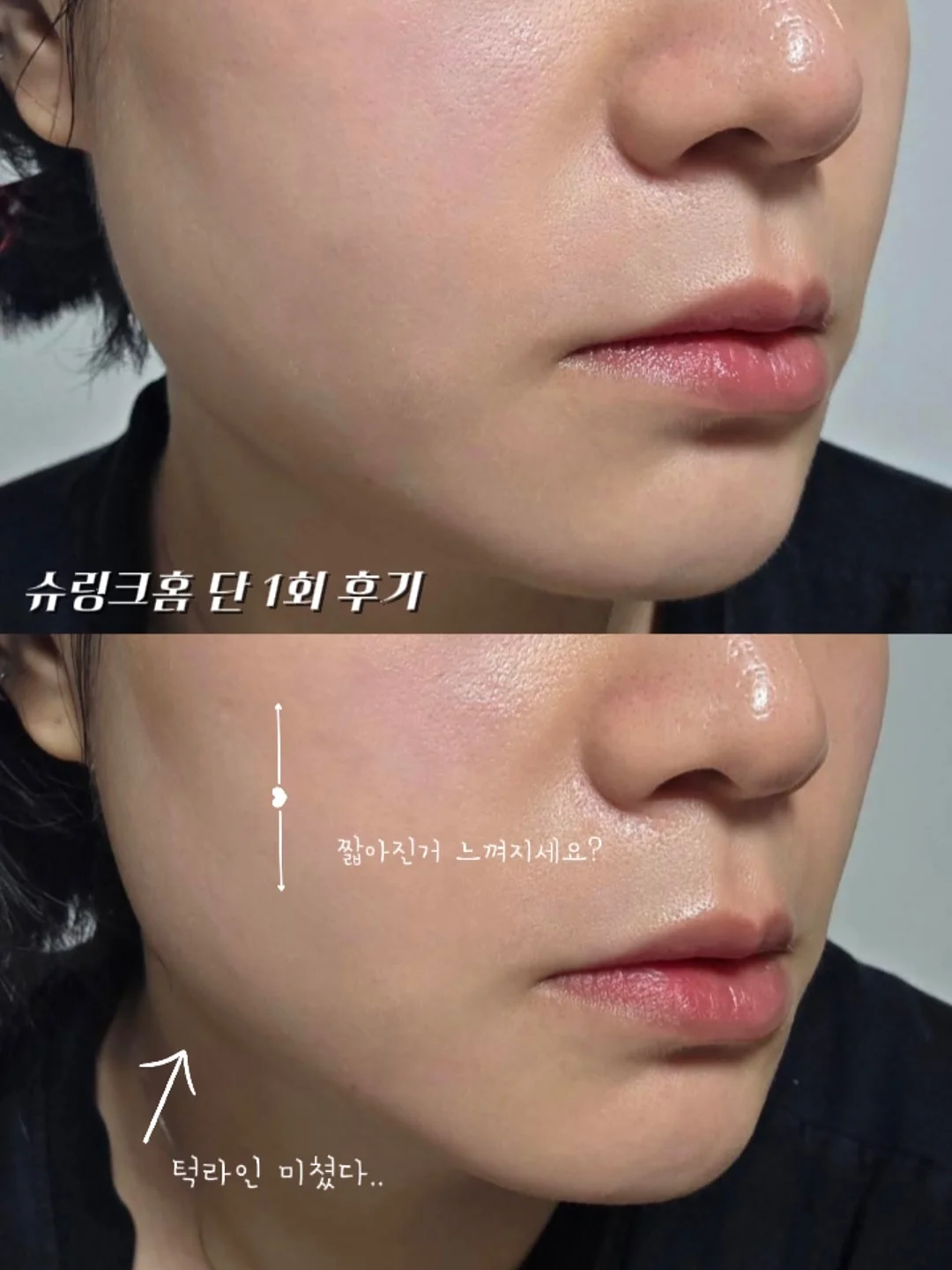 쿠셔닝 쪼리 5