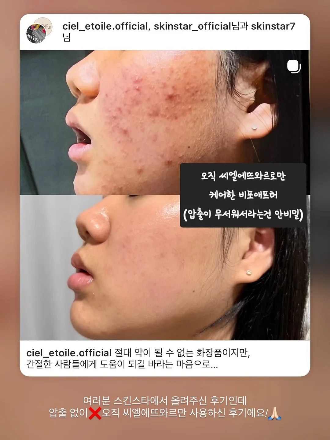 팔라스 x 카파 포 알파인 반팔 블루 15