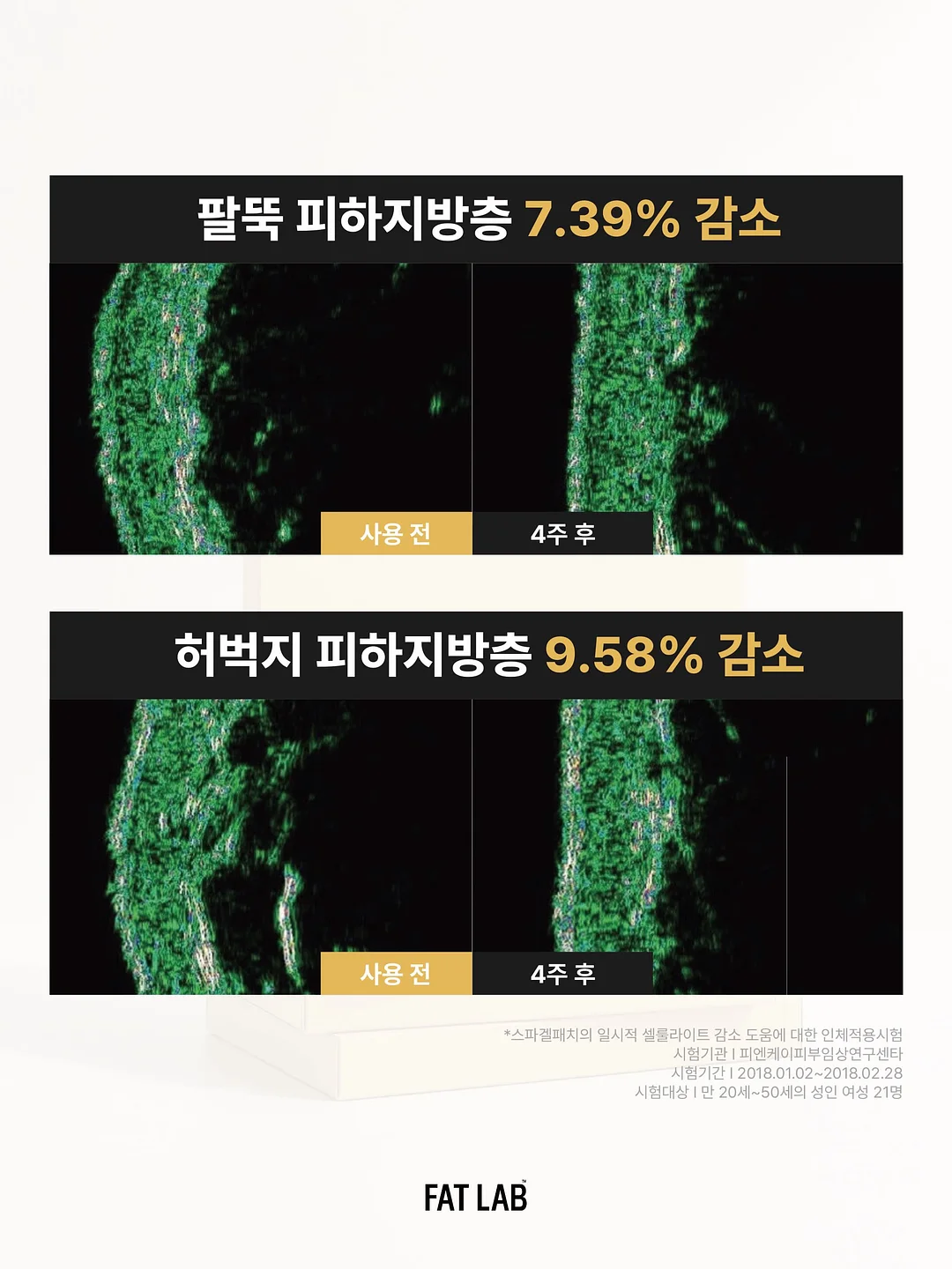 르무통 스카이 블루 슈즈 4
