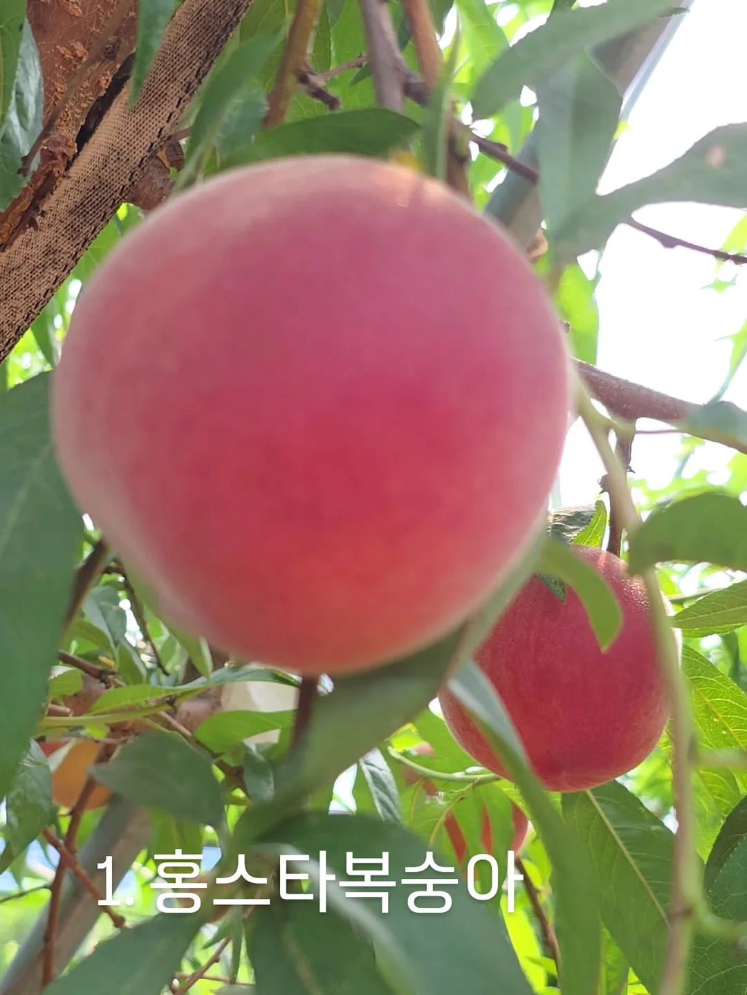 리프팅 시술 1