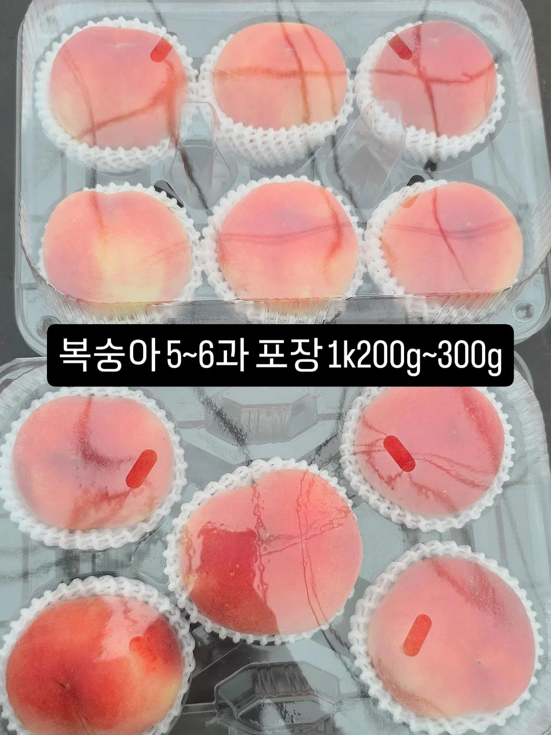 리프팅 시술 11