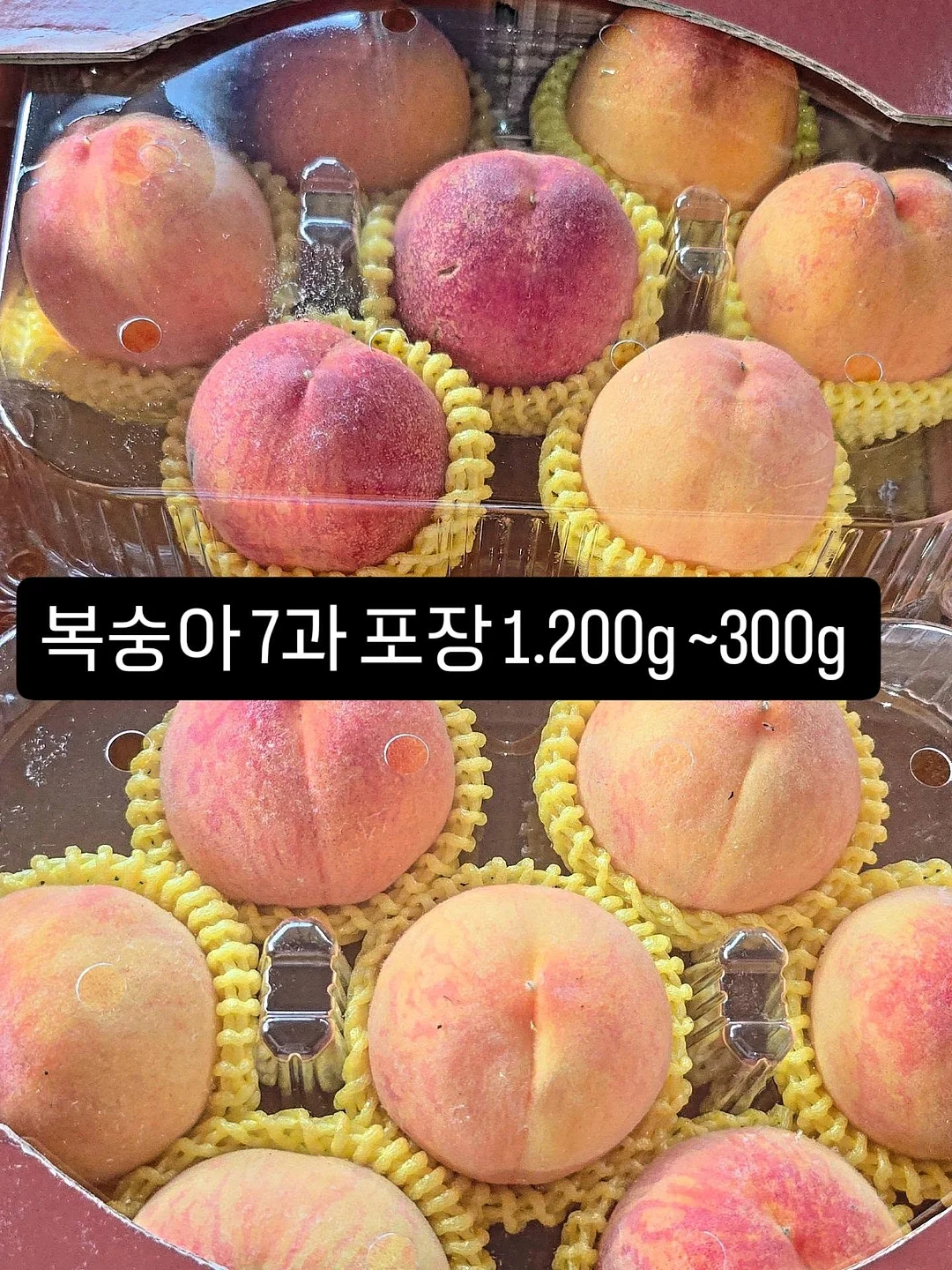 리프팅 시술 12