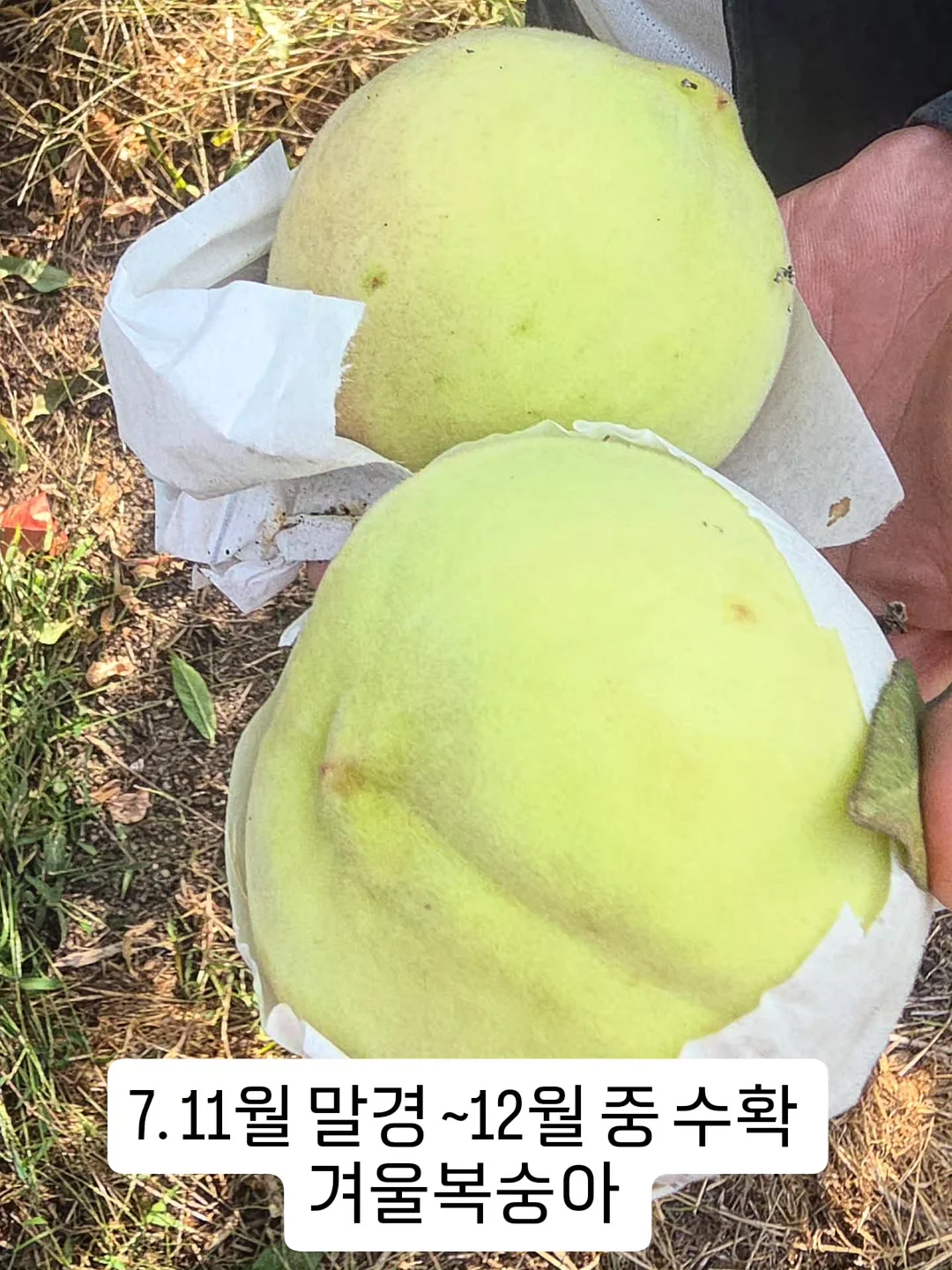 리프팅 시술 13