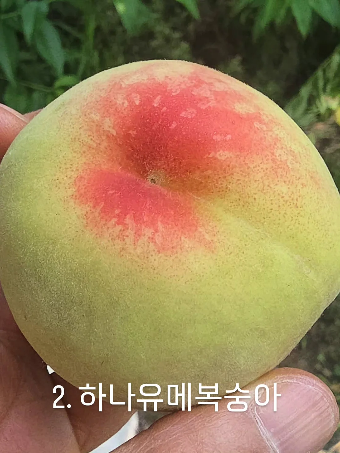 리프팅 시술 3