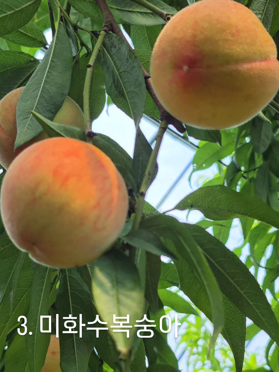 리프팅 시술 5