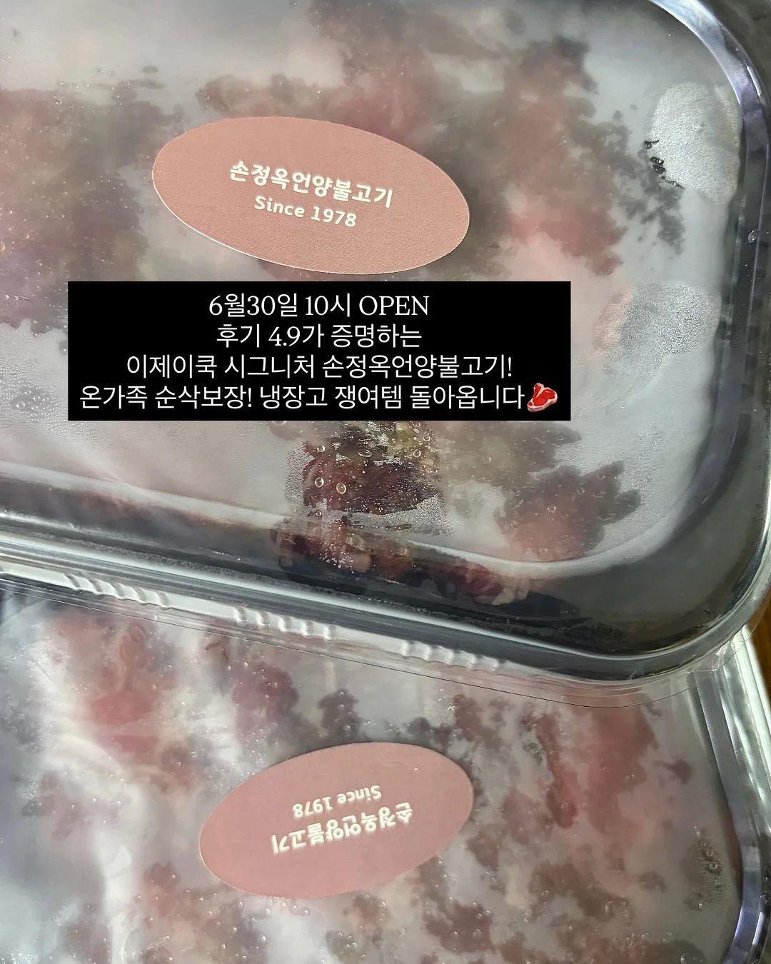 피부 리프팅 시술 7