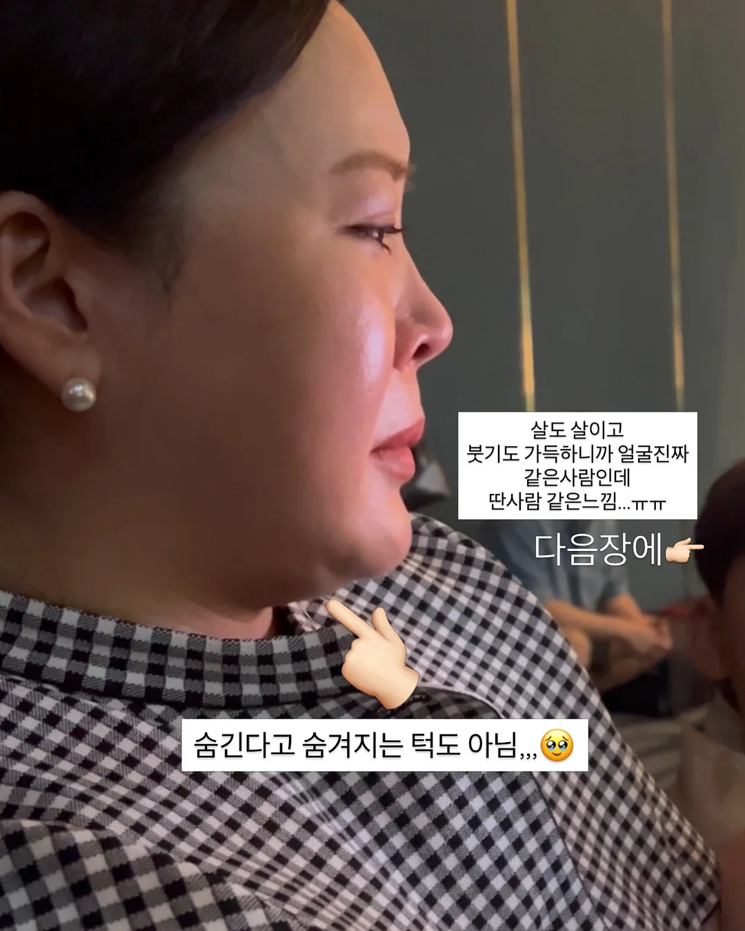 보로탈코 바디크림 3