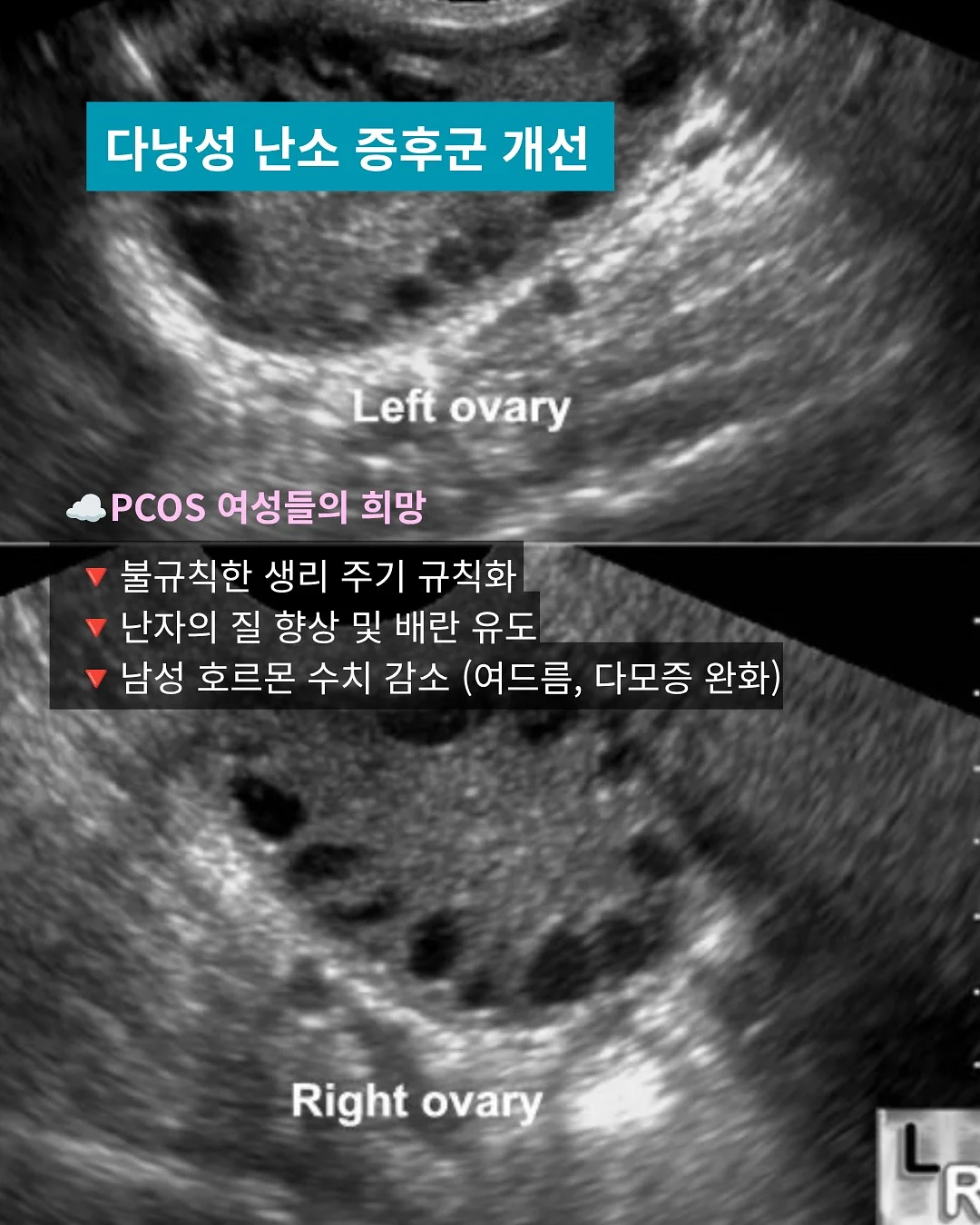 크롬 블랙 배색 반팔 4