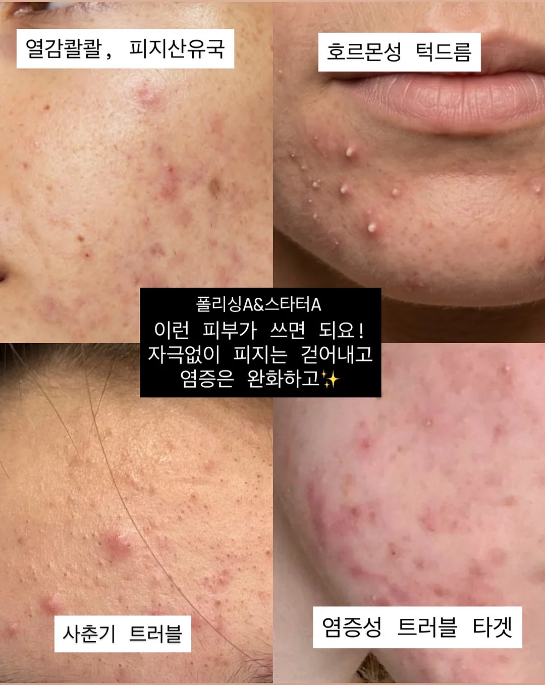 메리골드 린넨 원단 11