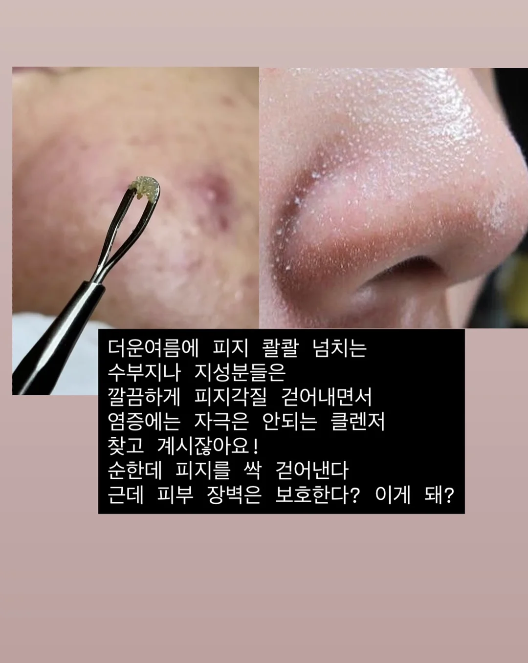 메리골드 린넨 원단 3