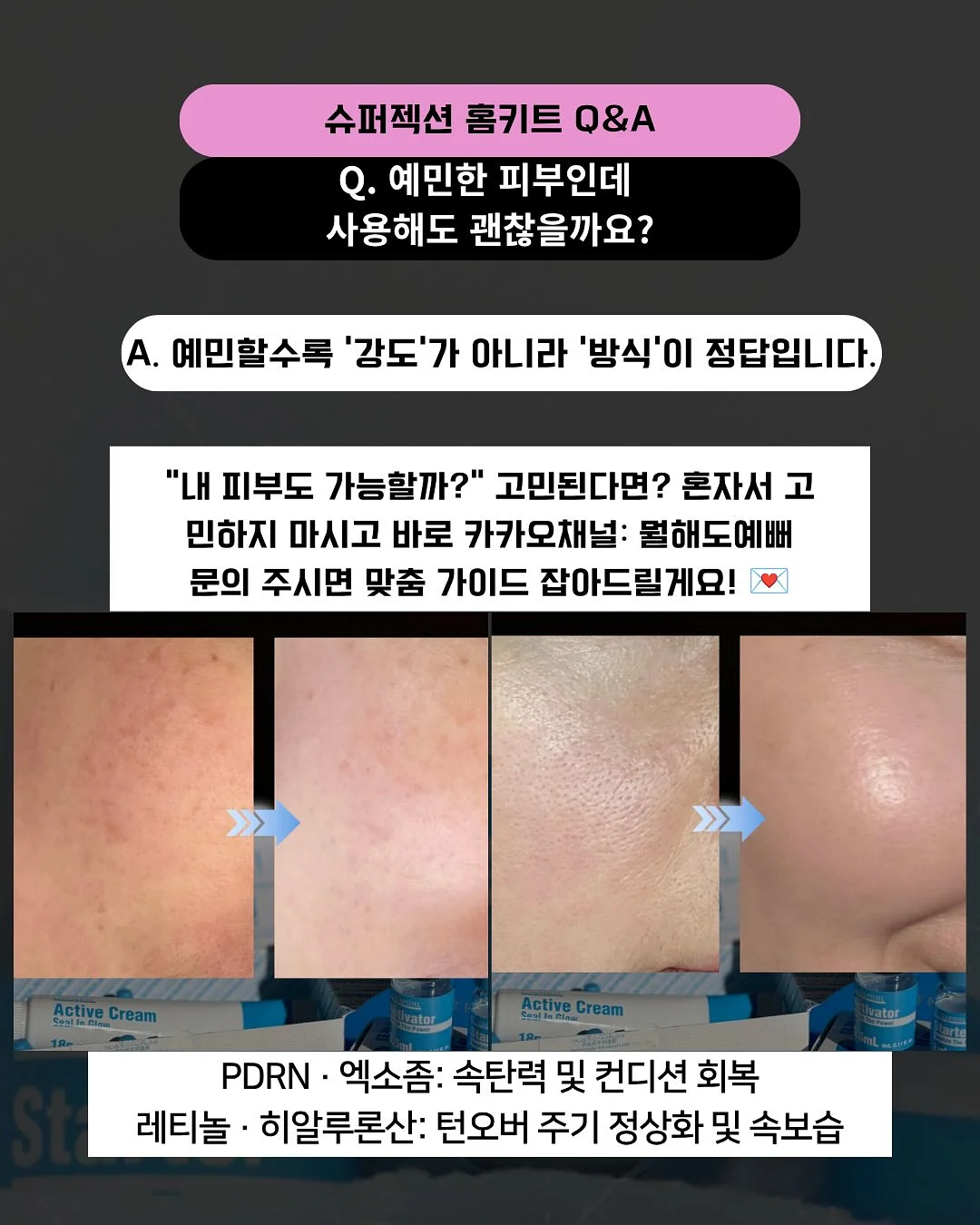 미니 암포라백 15