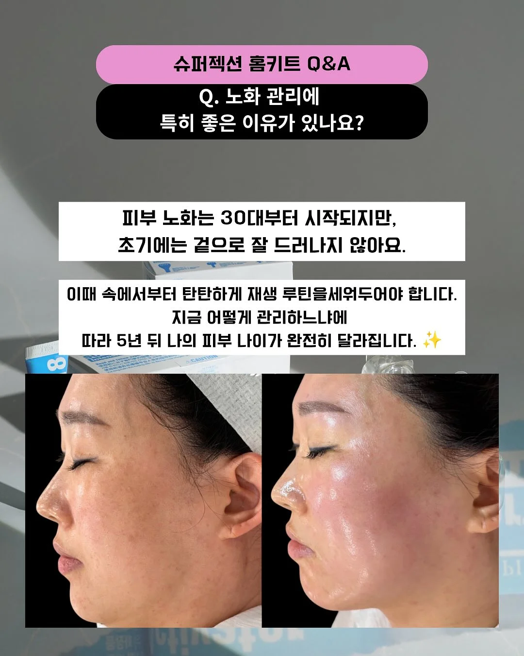 미니 암포라백 17