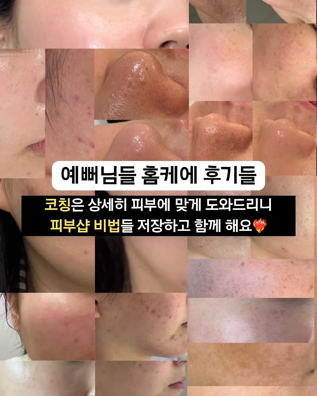 미니 암포라백 18