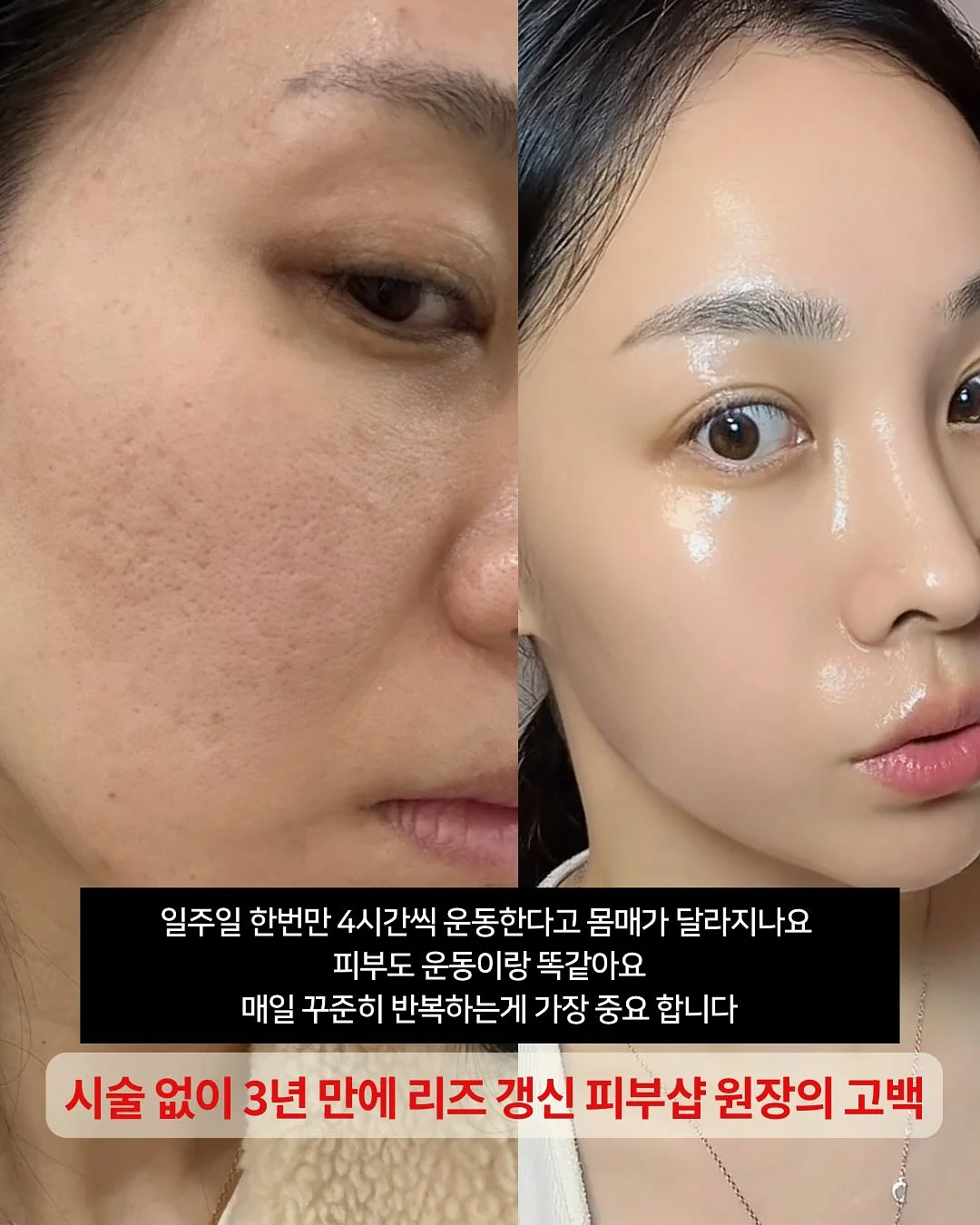 미니 암포라백 4