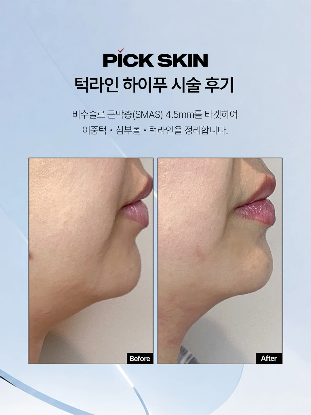 베베시앙 여름 행치프 마이벨 행치프