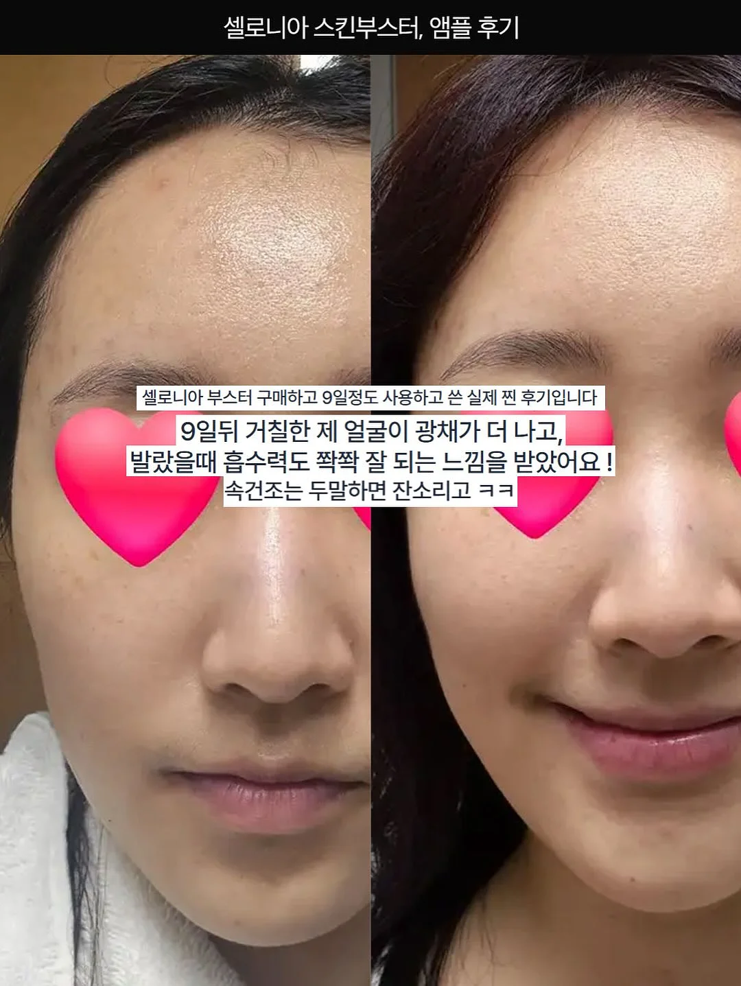 아베나키 오토슬라이드 슈퍼 릴렉스 체어 11