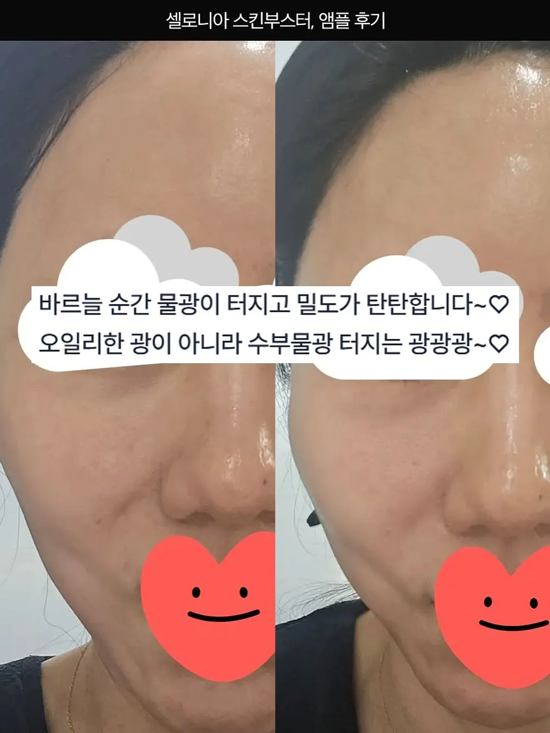 아베나키 오토슬라이드 슈퍼 릴렉스 체어 12