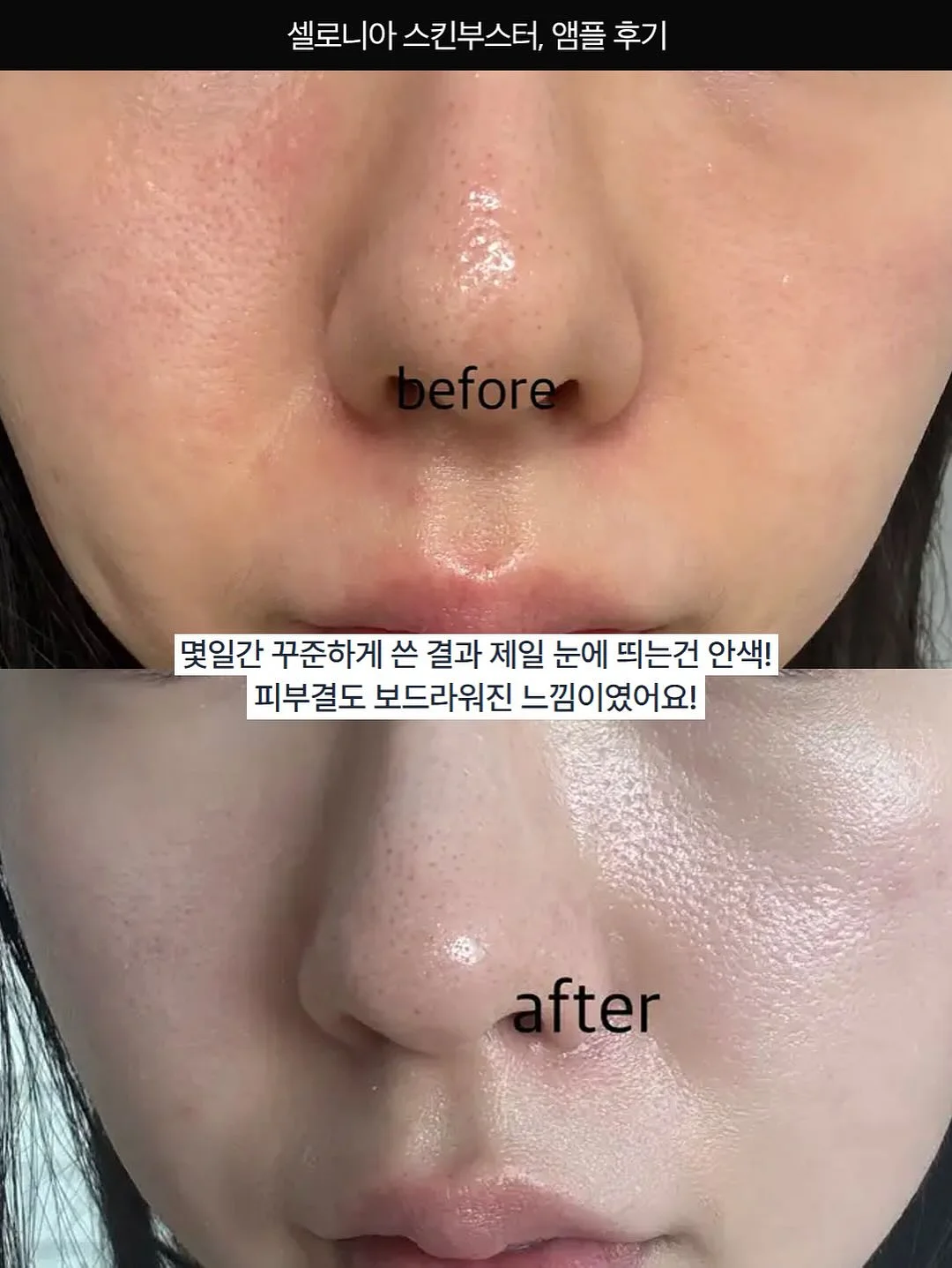 아베나키 오토슬라이드 슈퍼 릴렉스 체어 16