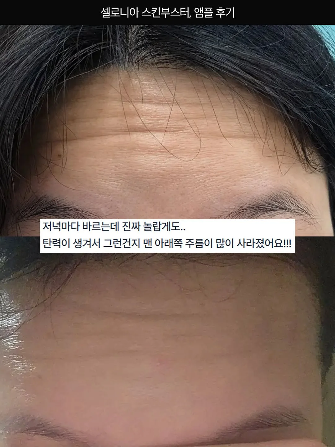 아베나키 오토슬라이드 슈퍼 릴렉스 체어 10