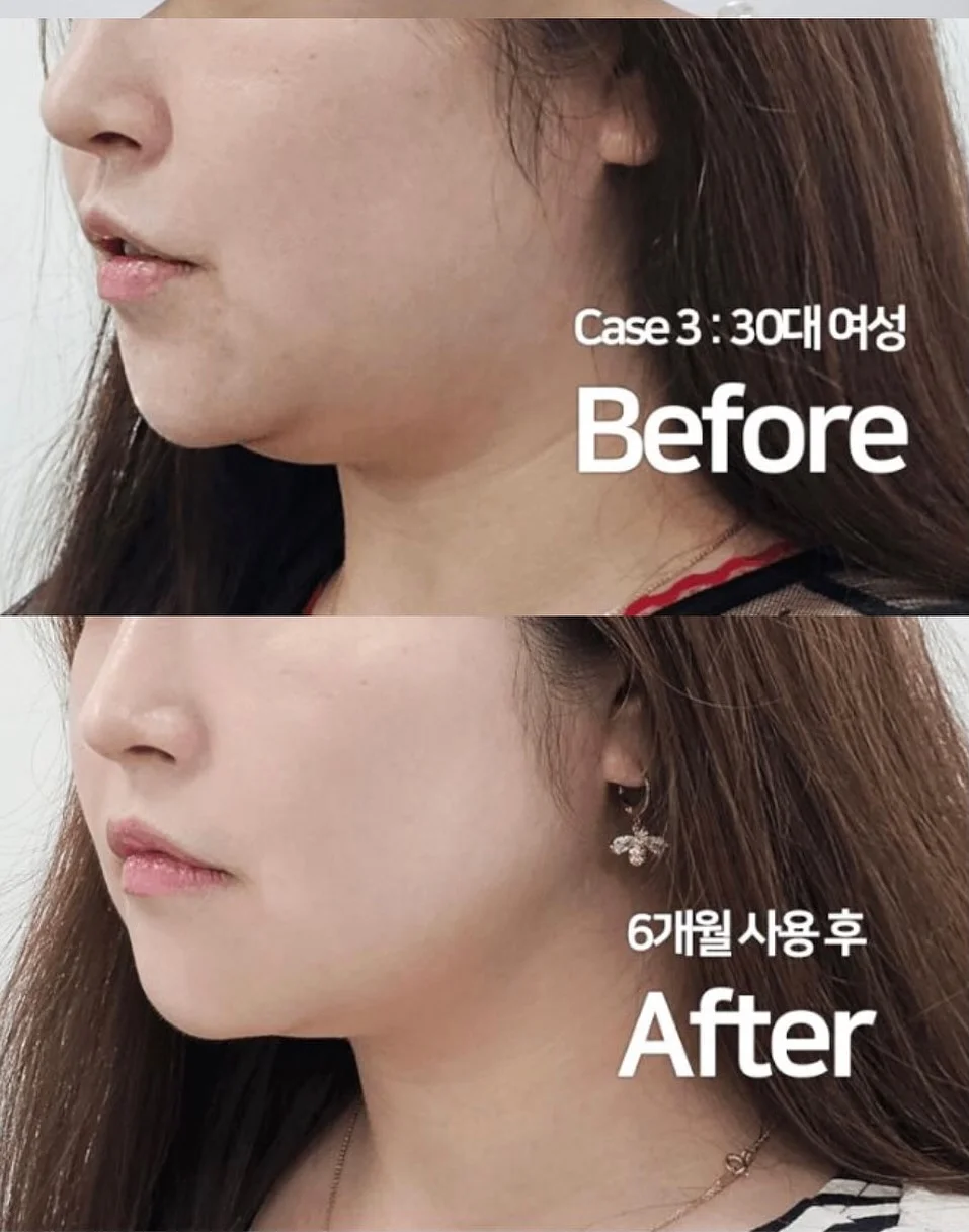 이삭토스트 햄치즈 토스트 4