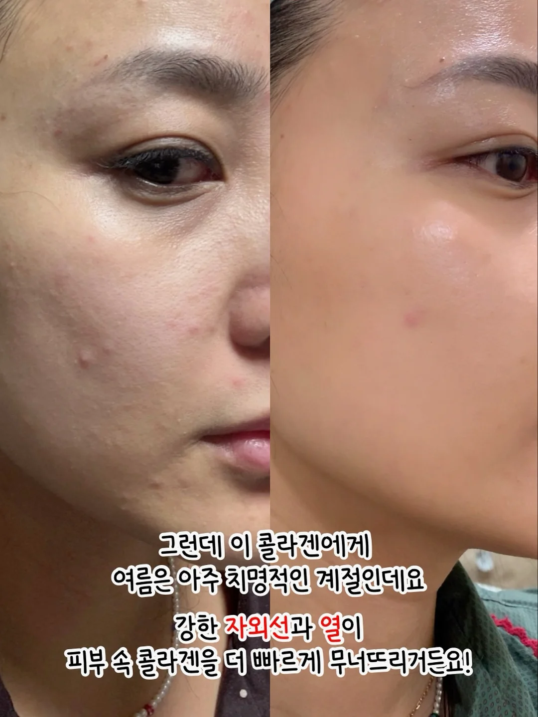 보그 수업 5