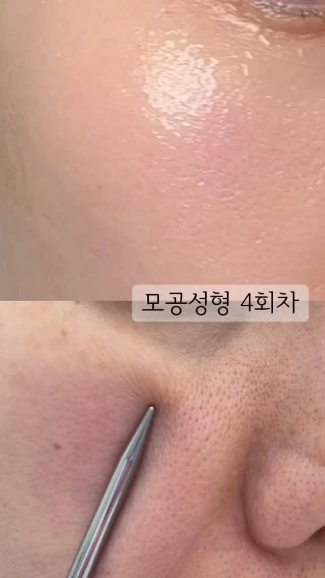 생일 케이크