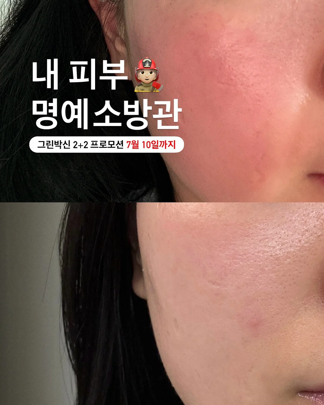 얼룩 제거제 1