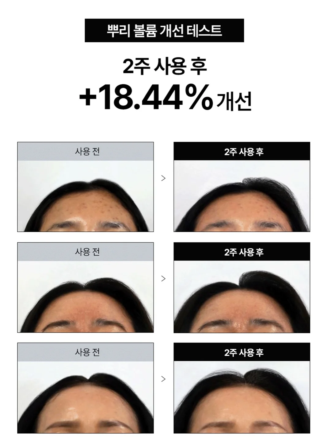 위고비 쥬스 8