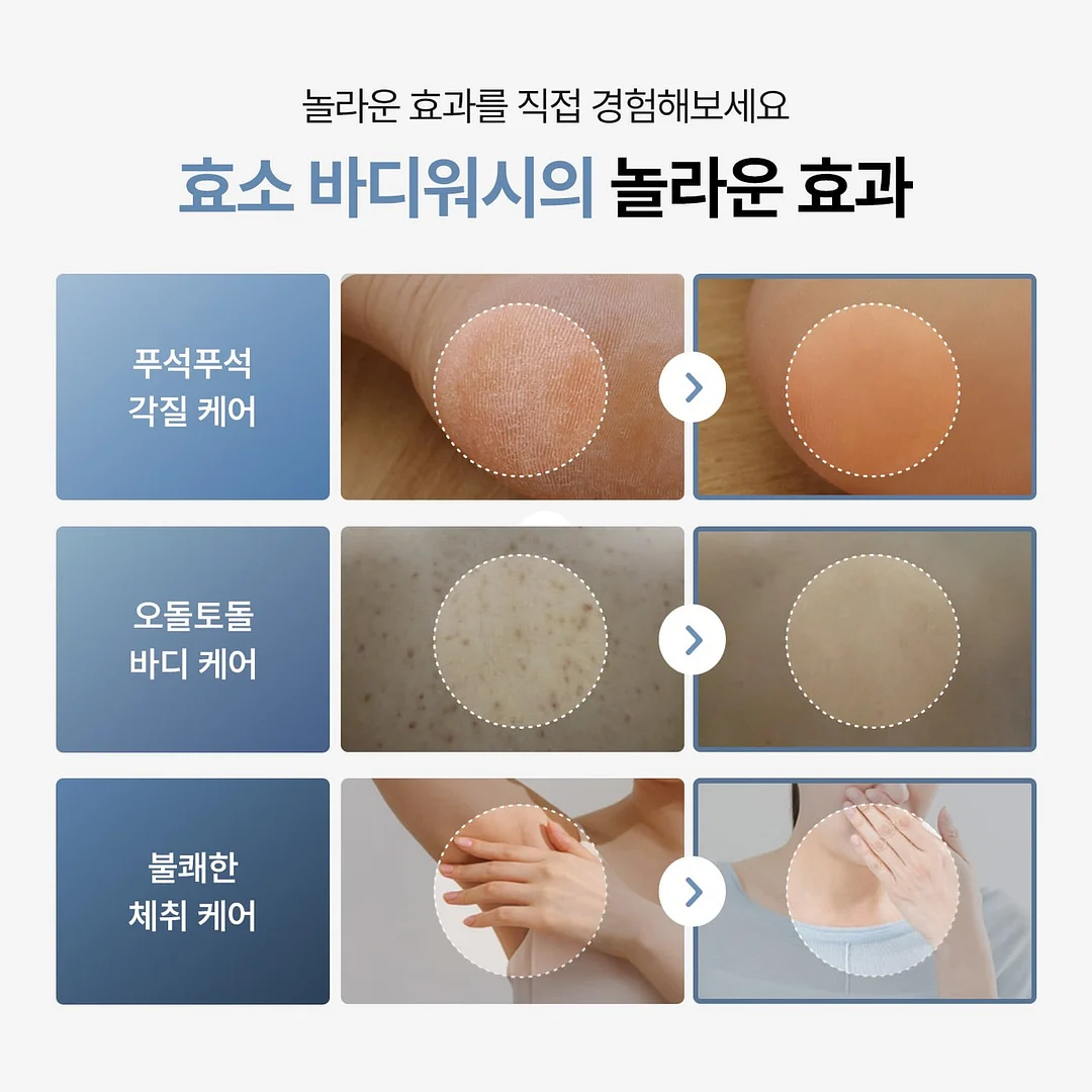 붉은대게 백간장 5