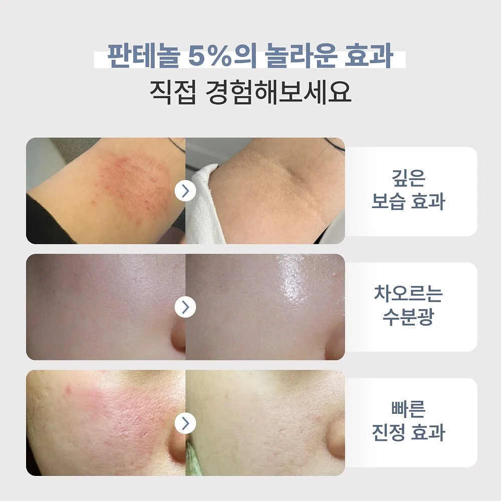 붉은대게 백간장 6