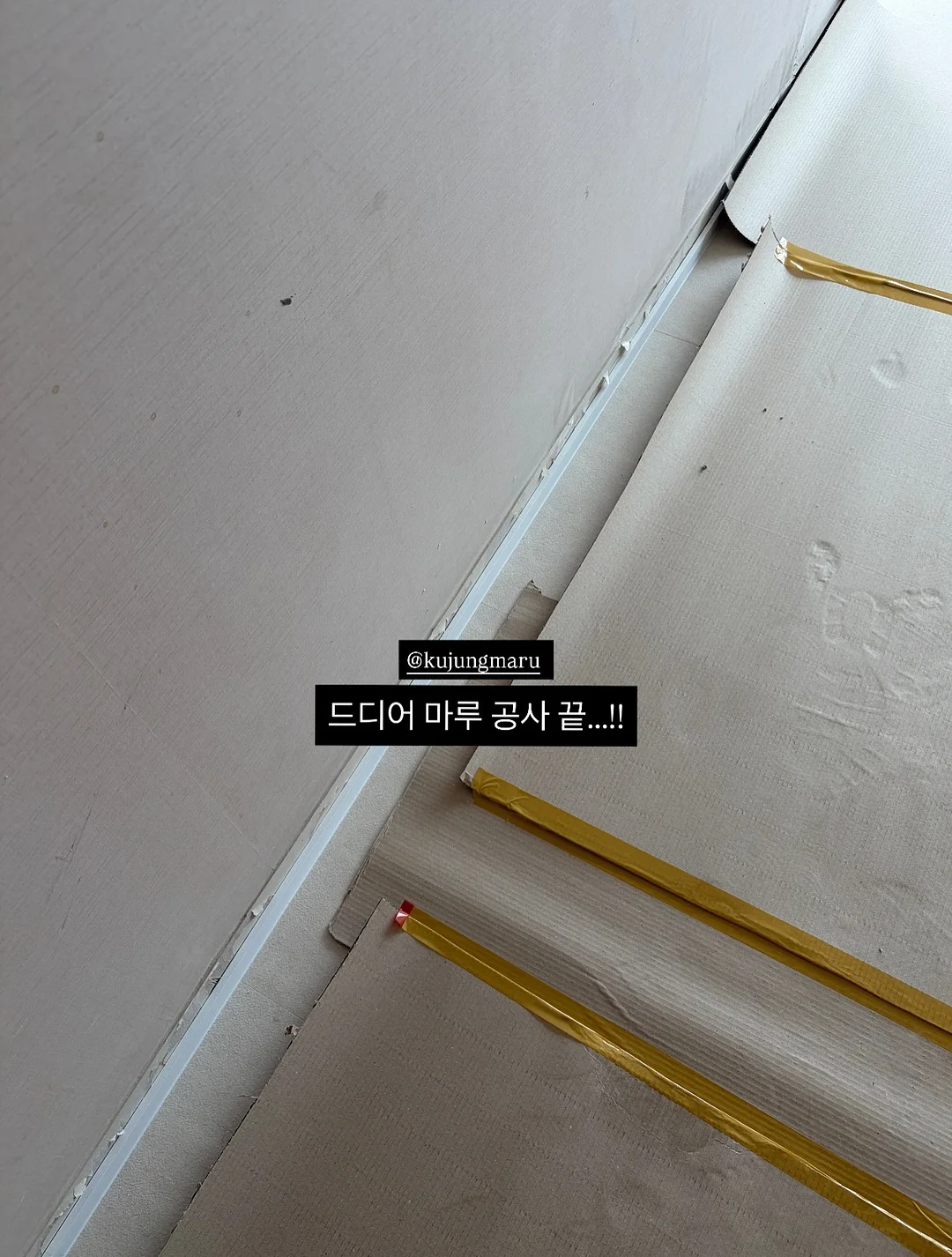 골드윤곽테라피 17