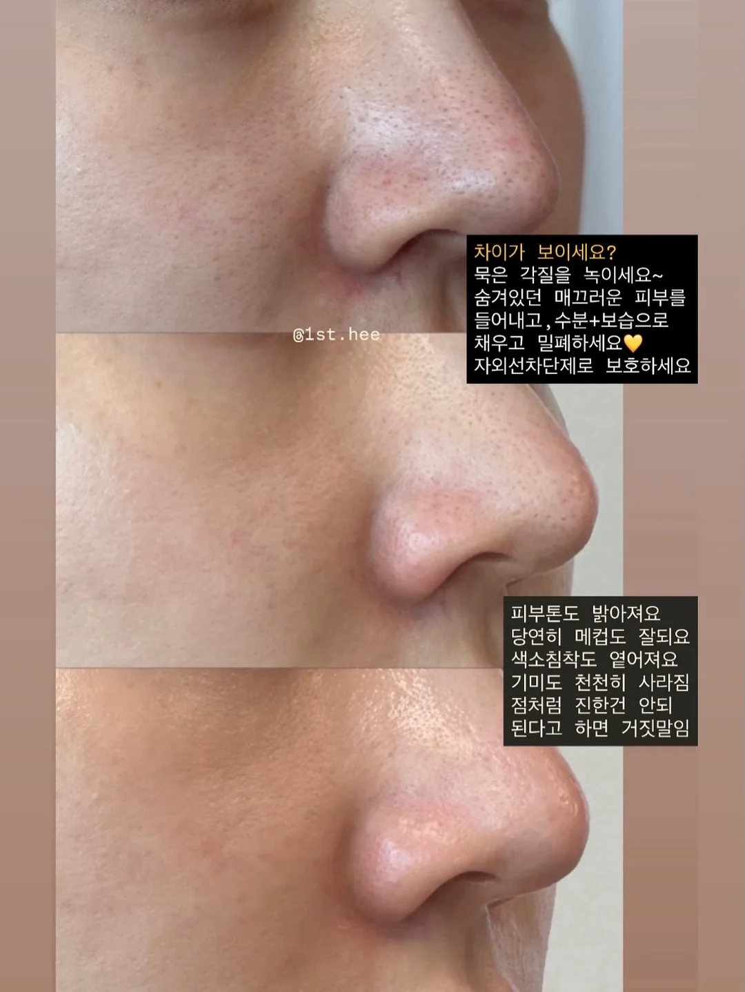 자동차나시상하 13