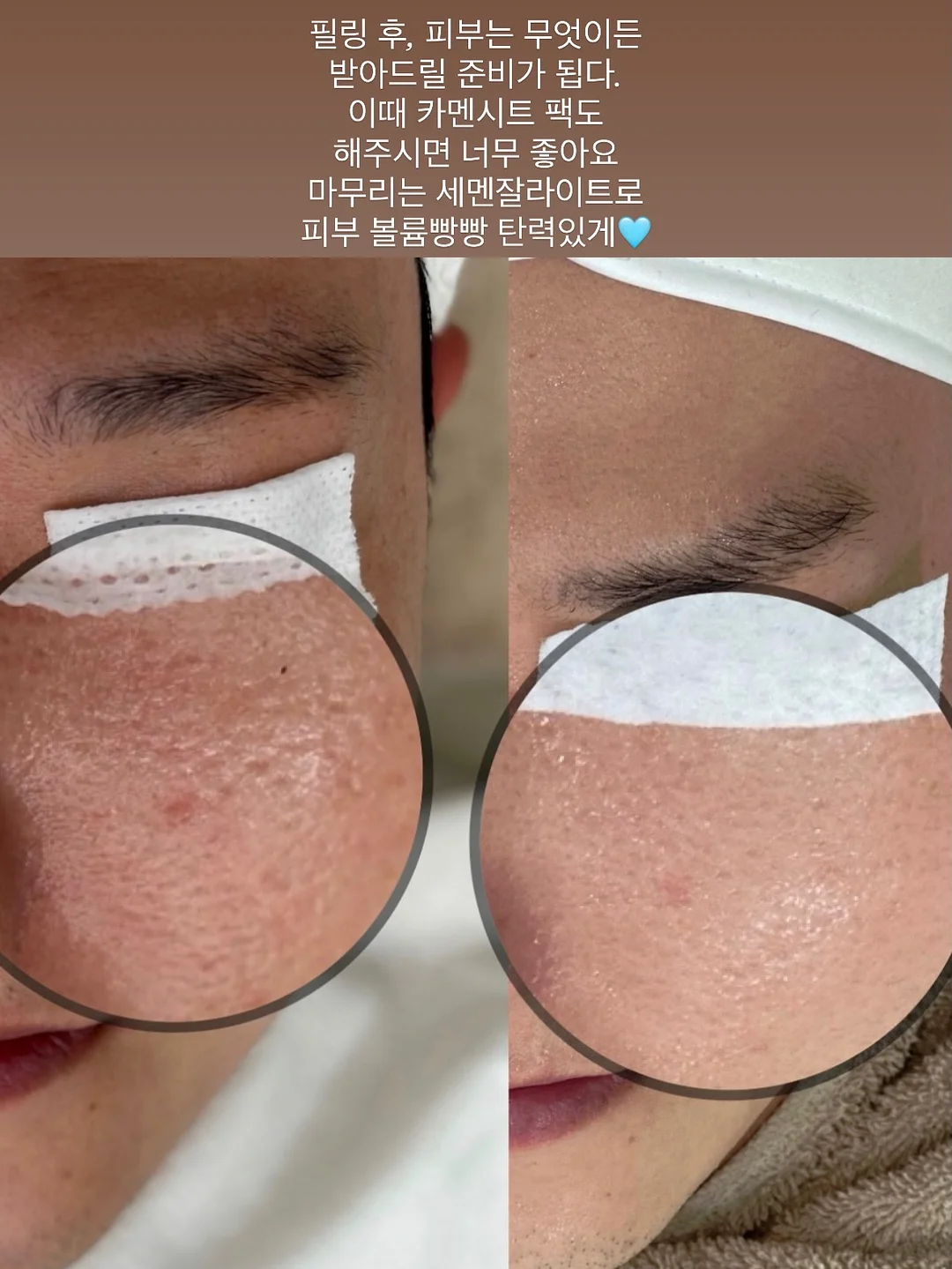 자동차나시상하 5