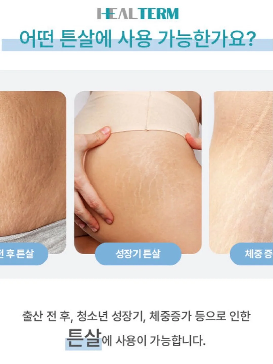 차량용 햇빛가리개 7