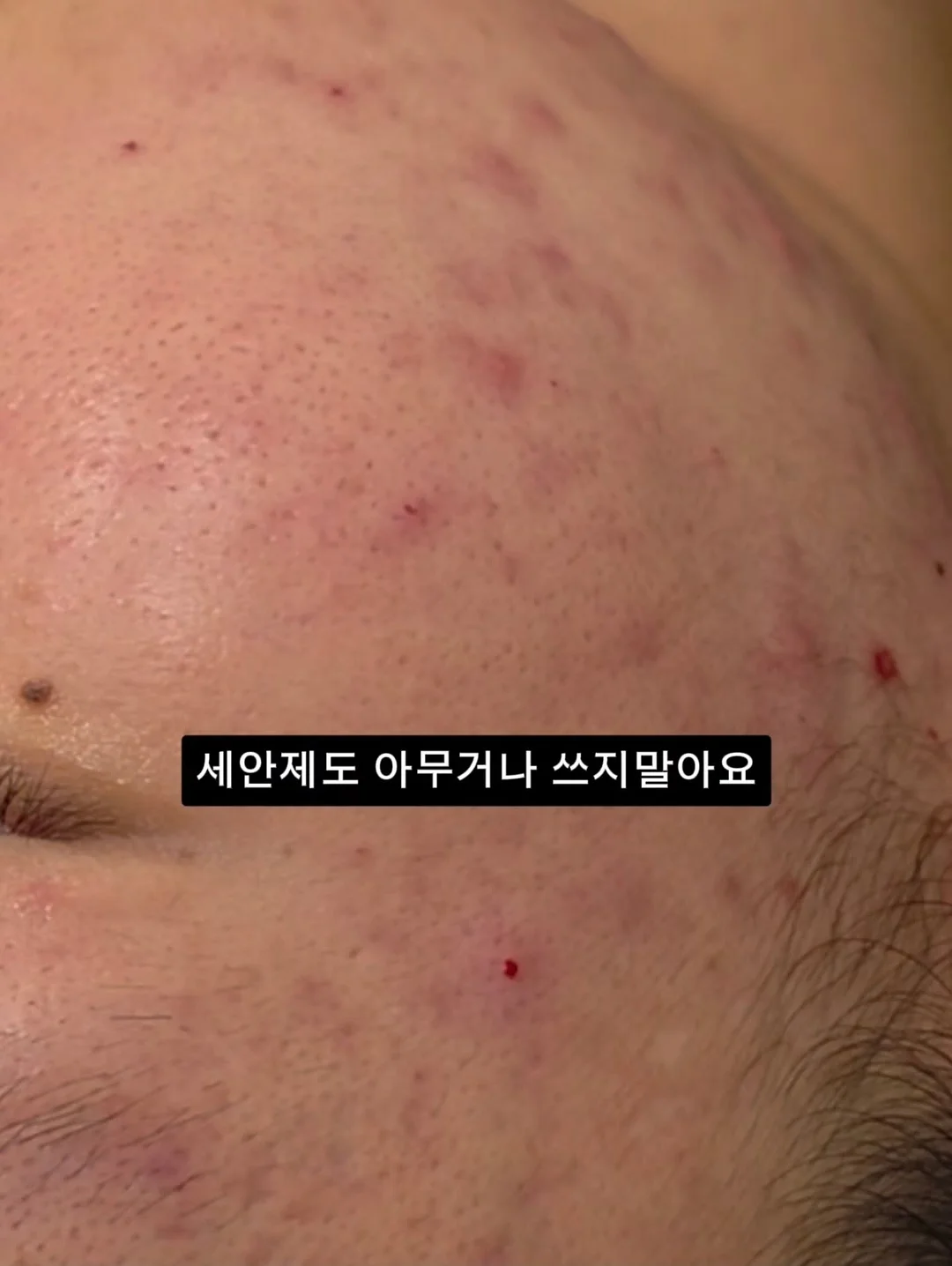 바다 케이크 1