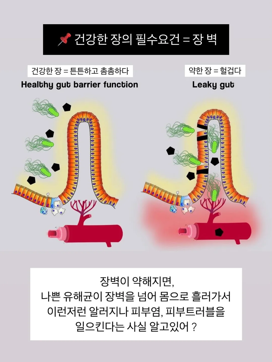 줄기세포 병원 13