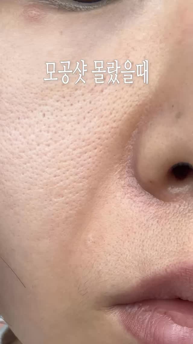 얼굴 데오도란트 미스트