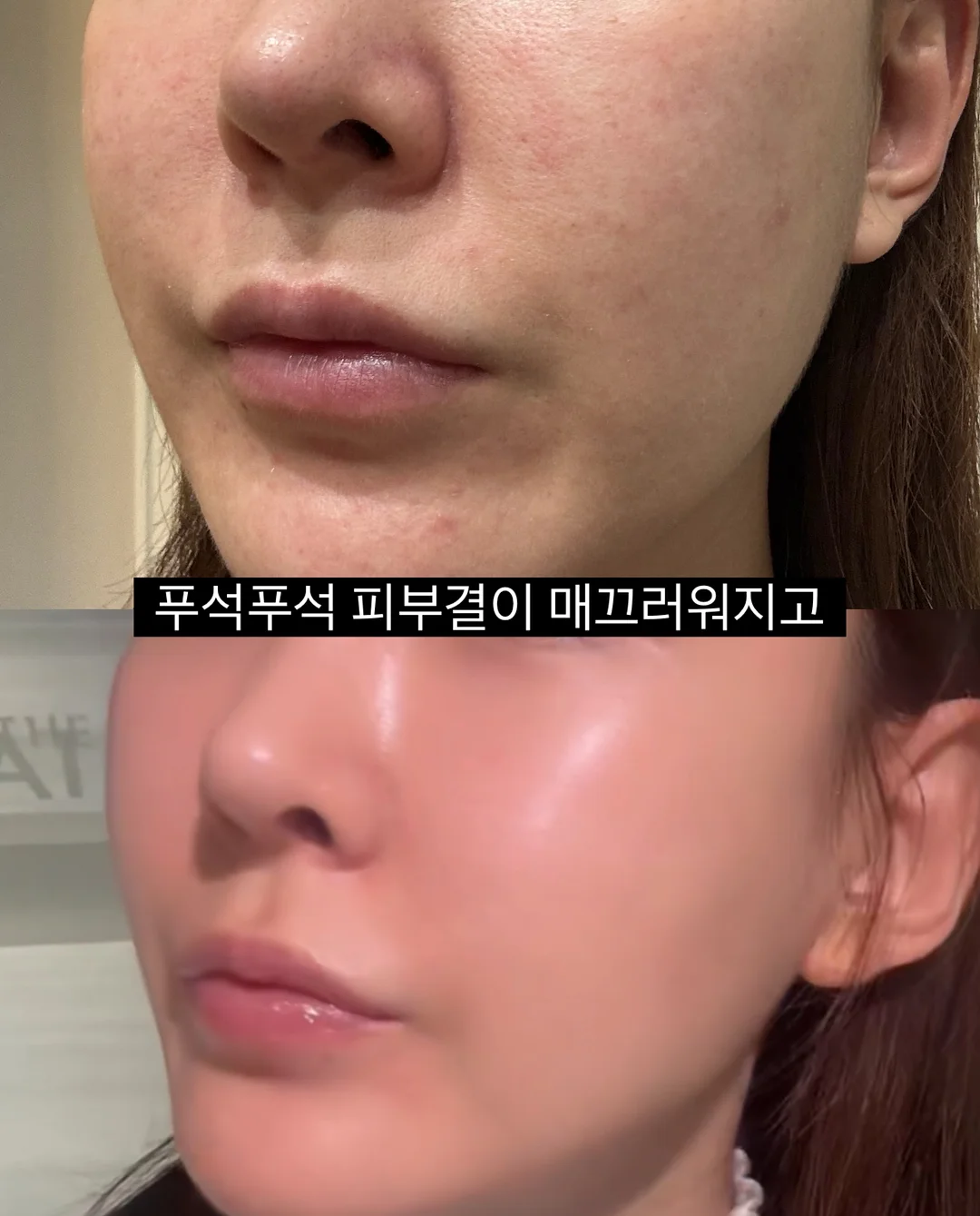 하이체어, 젖병 소독기, 젖병 세제&솔, 분유포트, 쉐이커, 침대 가드, 아기 장난감 5
